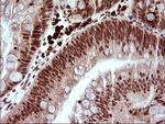 LMO2 Antibody in Immunohistochemistry (Paraffin) (IHC (P))