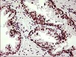 LMO2 Antibody in Immunohistochemistry (Paraffin) (IHC (P))