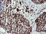 LMO2 Antibody in Immunohistochemistry (Paraffin) (IHC (P))