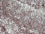 LMO2 Antibody in Immunohistochemistry (Paraffin) (IHC (P))