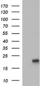 LMO2 Antibody in Western Blot (WB)