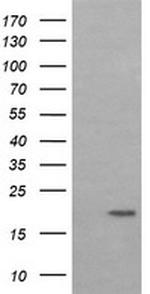 LMO2 Antibody in Western Blot (WB)