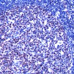 LMO2 Antibody in Immunohistochemistry (Paraffin) (IHC (P))