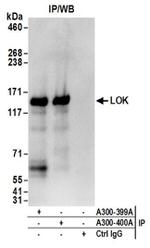 LOK Antibody in Western Blot (WB)