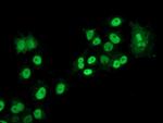 LOX Antibody in Immunocytochemistry (ICC/IF)