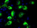 LOX Antibody in Immunocytochemistry (ICC/IF)