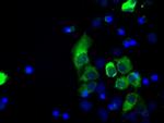 LOX Antibody in Immunocytochemistry (ICC/IF)