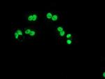 LOX Antibody in Immunocytochemistry (ICC/IF)