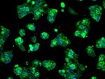 LOX Antibody in Immunocytochemistry (ICC/IF)