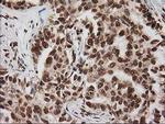 LOX Antibody in Immunohistochemistry (Paraffin) (IHC (P))