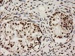 LOX Antibody in Immunohistochemistry (Paraffin) (IHC (P))