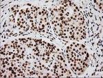 LOX Antibody in Immunohistochemistry (Paraffin) (IHC (P))