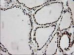 LOX Antibody in Immunohistochemistry (Paraffin) (IHC (P))