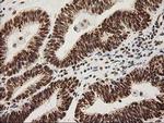 LOX Antibody in Immunohistochemistry (Paraffin) (IHC (P))