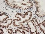 LOX Antibody in Immunohistochemistry (Paraffin) (IHC (P))