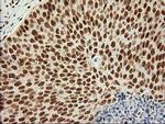 LOX Antibody in Immunohistochemistry (Paraffin) (IHC (P))