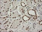 LOX Antibody in Immunohistochemistry (Paraffin) (IHC (P))