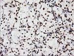 LOX Antibody in Immunohistochemistry (Paraffin) (IHC (P))