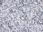 LOX Antibody in Immunohistochemistry (Paraffin) (IHC (P))