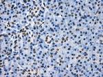 LOX Antibody in Immunohistochemistry (Paraffin) (IHC (P))