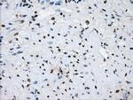 LOX Antibody in Immunohistochemistry (Paraffin) (IHC (P))