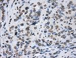 LOX Antibody in Immunohistochemistry (Paraffin) (IHC (P))