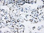 LOX Antibody in Immunohistochemistry (Paraffin) (IHC (P))