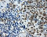 LOX Antibody in Immunohistochemistry (Paraffin) (IHC (P))