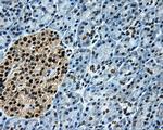 LOX Antibody in Immunohistochemistry (Paraffin) (IHC (P))