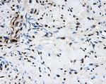 LOX Antibody in Immunohistochemistry (Paraffin) (IHC (P))