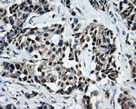 LOX Antibody in Immunohistochemistry (Paraffin) (IHC (P))