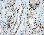 LOX Antibody in Immunohistochemistry (Paraffin) (IHC (P))