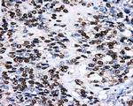 LOX Antibody in Immunohistochemistry (Paraffin) (IHC (P))