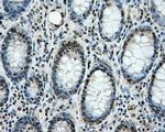 LOX Antibody in Immunohistochemistry (Paraffin) (IHC (P))