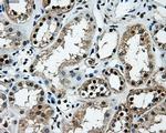 LOX Antibody in Immunohistochemistry (Paraffin) (IHC (P))