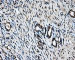 LOX Antibody in Immunohistochemistry (Paraffin) (IHC (P))