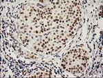 LOX Antibody in Immunohistochemistry (Paraffin) (IHC (P))