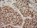 LOX Antibody in Immunohistochemistry (Paraffin) (IHC (P))