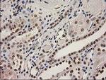 LOX Antibody in Immunohistochemistry (Paraffin) (IHC (P))