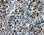 LOX Antibody in Immunohistochemistry (Paraffin) (IHC (P))