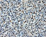 LOX Antibody in Immunohistochemistry (Paraffin) (IHC (P))