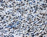 LOX Antibody in Immunohistochemistry (Paraffin) (IHC (P))