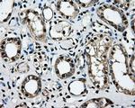 LOX Antibody in Immunohistochemistry (Paraffin) (IHC (P))