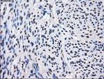 LOX Antibody in Immunohistochemistry (Paraffin) (IHC (P))