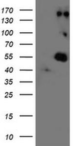 LOX Antibody in Western Blot (WB)