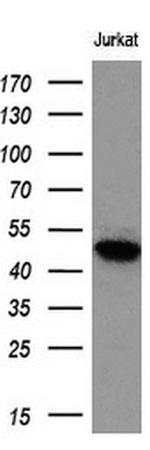 LOX Antibody in Western Blot (WB)
