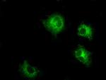 LOX Antibody in Western Blot (WB)