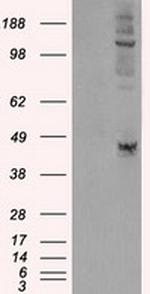 LOX Antibody in Western Blot (WB)