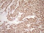 LPIN1 Antibody in Immunohistochemistry (Paraffin) (IHC (P))