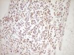 LPIN1 Antibody in Immunohistochemistry (Paraffin) (IHC (P))